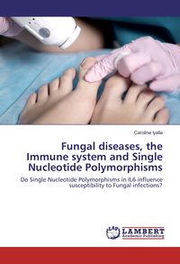 Produktbild: Fungal diseases, the Immune system and Single Nucleotide Polymorphisms