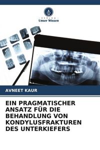 Produktbild: Ein Pragmatischer Ansatz f&uuml;r die Behandlung von Kondylusfrakturen des Unterkiefers