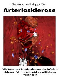 Produktbild: Gesundheitstipp f&uuml;r Arteriosklerose