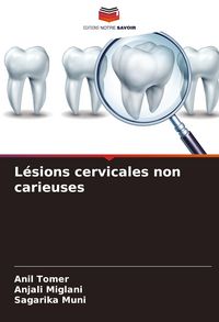 Produktbild: L&eacute;sions cervicales non carieuses