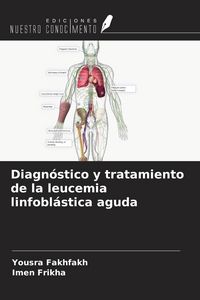 Produktbild: Diagn&oacute;stico y tratamiento de la leucemia linfobl&aacute;stica aguda