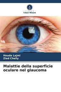 Produktbild: Malattie della superficie oculare nel glaucoma