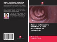 Produktbild: Doen&ccedil;a inflamat&oacute;ria intestinal e suas estrat&eacute;gias de tratamento