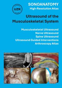 Produktbild: Sonoanatomy - High-Resolution Atlas - Ultrasound of the Musculoskeletal System