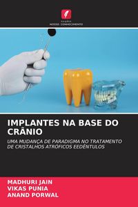 Produktbild: IMPLANTES NA BASE DO CR&Acirc;NIO