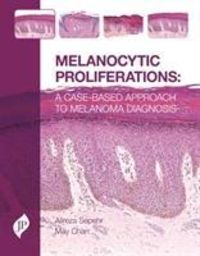 Produktbild: Sepehr, A: Melanocytic Proliferations