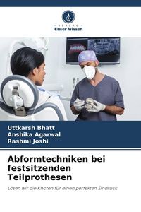 Produktbild: Abformtechniken bei festsitzenden Teilprothesen