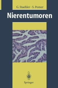 Produktbild: Nierentumoren