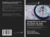 Produktbild: Topograf&iacute;a en la ciencia del C&aacute;ncer de colon izquierdo y derecho