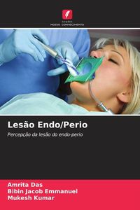 Produktbild: Les&atilde;o Endo/Perio