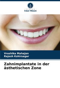 Produktbild: Zahnimplantate in der &auml;sthetischen Zone