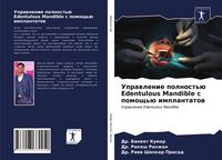 Produktbild: Uprawlenie polnost'&uuml; Edentulous Mandible s pomosch'&uuml; implantatow