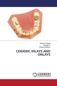 Produktbild: Ceramic Inlays and Onlays