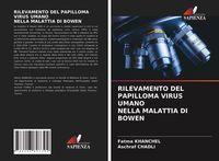 Produktbild: RILEVAMENTO DEL PAPILLOMA VIRUS UMANO NELLA MALATTIA DI BOWEN