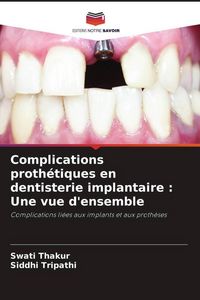 Produktbild: Complications proth&eacute;tiques en dentisterie implantaire : Une vue d'ensemble