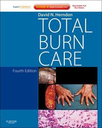 Produktbild: Total Burn Care