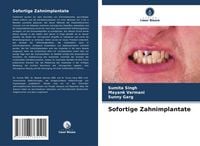 Produktbild: Sofortige Zahnimplantate