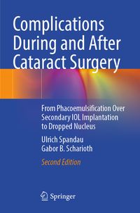 Produktbild: Complications During and After Cataract Surgery