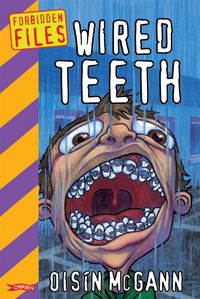 Produktbild: Wired Teeth