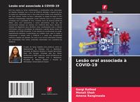 Produktbild: Les&atilde;o oral associada &agrave; COVID-19