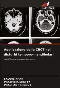 Produktbild: Applicazione della CBCT nei disturbi temporo-mandibolari