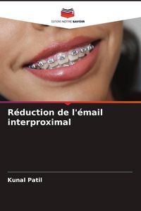 Produktbild: R&eacute;duction de l'&eacute;mail interproximal