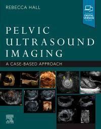 Produktbild: Pelvic Ultrasound Imaging