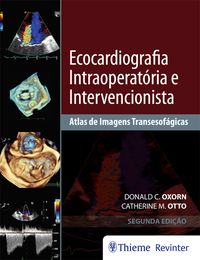 Produktbild: Ecocardiografia Intraoperat&oacute;ria e Intervencionista
