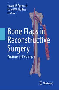 Produktbild: Bone Flaps in Reconstructive Surgery