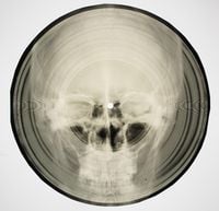 Produktbild: Coates, S., Bone Music
