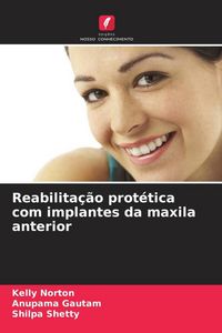 Produktbild: Reabilita&ccedil;&atilde;o prot&eacute;tica com implantes da maxila anterior
