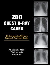Produktbild: 200 Chest X-Ray Cases