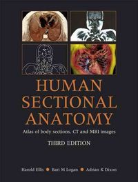 Produktbild: Human Sectional Anatomy: Atlas of Body Sections, CT and MRI Images