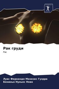 Produktbild: Rak grudi