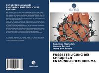 Produktbild: FUSSBETEILIGUNG BEI CHRONISCH ENTZ&Uuml;NDLICHEM RHEUMA