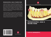 Produktbild: Autoenxertos: osso e tecido mole