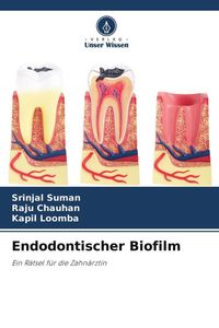 Produktbild: Endodontischer Biofilm
