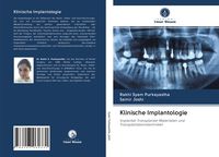 Produktbild: Klinische Implantologie