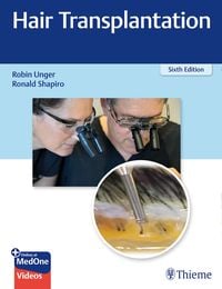 Produktbild: Hair Transplantation