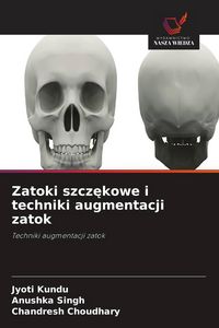 Produktbild: Zatoki szcz&iquest;kowe i techniki augmentacji zatok