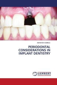 Produktbild: PERIODONTAL CONSIDERATIONS IN IMPLANT DENTISTRY
