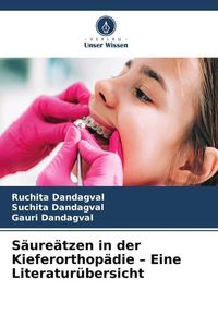 Produktbild: S&auml;ure&auml;tzen in der Kieferorthop&auml;die - Eine Literatur&uuml;bersicht