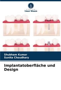Produktbild: Implantatoberfl&auml;che und Design