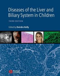 Produktbild: Diseases of the Liver and Biliary System in Children
