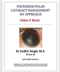 Produktbild: Posterior Polar Cataract Management: My Approach (2022, #1)