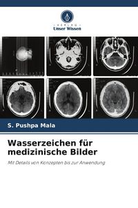 Produktbild: Wasserzeichen f&uuml;r medizinische Bilder