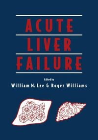 Produktbild: Acute Liver Failure