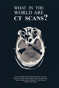Produktbild: What in the World are CT Scans?