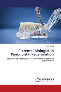 Produktbild: Placental Biologics in Periodontal Regeneration