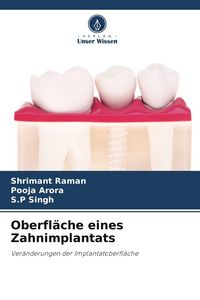 Produktbild: Oberfl&auml;che eines Zahnimplantats